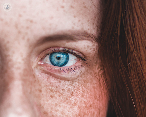 Up close shot of a woman with blue eyes and freckles 