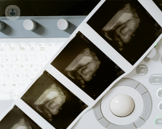 3D Ultrasound