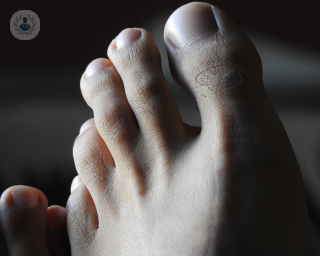 An image of a toe