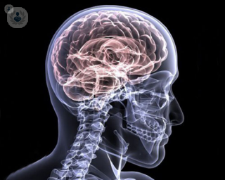 Traumatic brain injury image. 