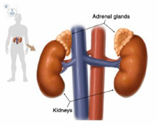 Adrenal gland disorders. 