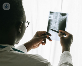 A doctor holds an X-ray of a spinal column to a light