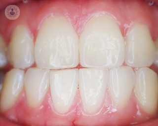 An image of teeth