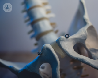 Minimally invasive spinal surgery offers patients at less invasive option compared to traditional open surgery.