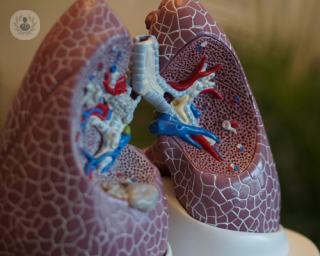 Model of lungs, which are assessed during a lung cancer screening
