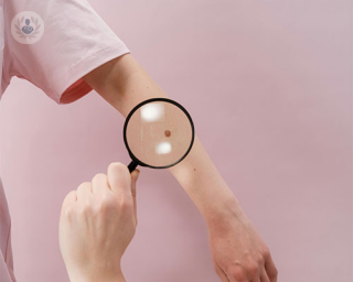 A mole on an arm is examined under a magnifying glass