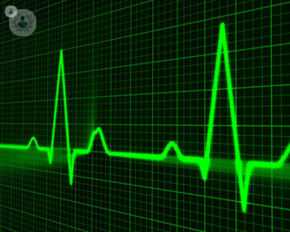 green heart beat on monitor