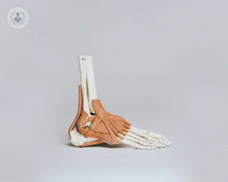 Ankle distraction arthroplasty is designed to treat advanced ankle arthritis.