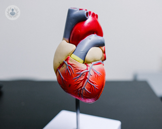 A 3D model of the heart, showing the coronary arteries.