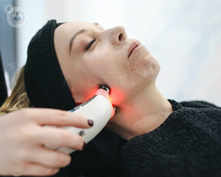 Facial laser treatments. 