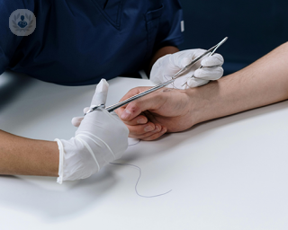 A surgeon stitching a patient's base of the thumb.