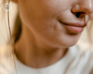 A woman has one of her recurrent nosebleeds