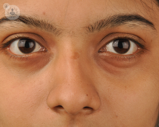 Can cataract surgery lead to the development of endophthalmitis?