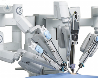 A picture of a robot used in robotic assisted surgery