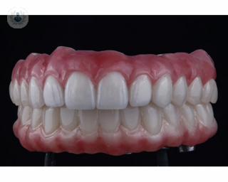 A 3D model of the mouth. A full mouth rehabilitation is a transformative dental treatment designed to restore the health, function, and aesthetics of your entire mouth.