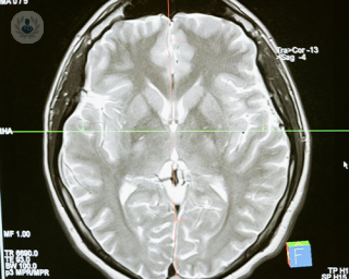 pituitary gland tumours