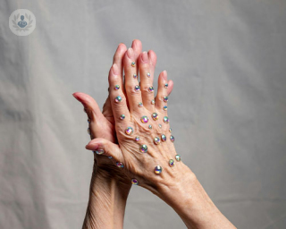 Two hands with decorative, reflective orbs stuck along the bones and joints, glittering in the sunlight against a grey backdrop