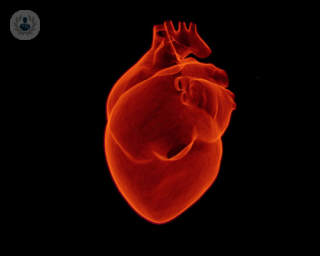 Who should undergo cardiac screening?