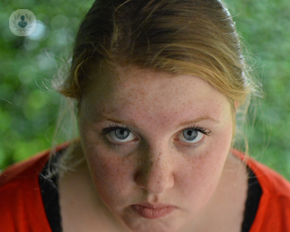 A young girl with rosacea.