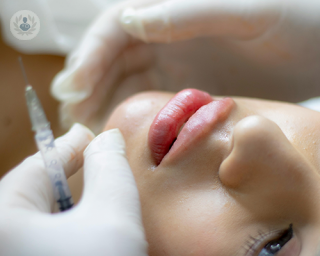 A young woman getting a dermal filler injection.