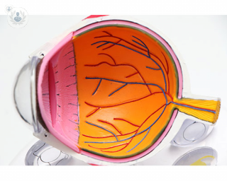 A diagram of the inside of the eye, showing the retina and vitreous gel.