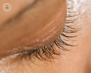 Woman's eyelid after having a blepharoplasty procedure