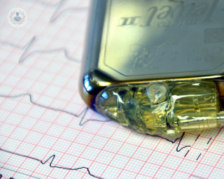 The fitting procedure for pacemakers is a minor operation