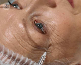 Older woman having ophthalmological treatment using Botox™ 
