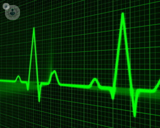 mointor for arrhythmia