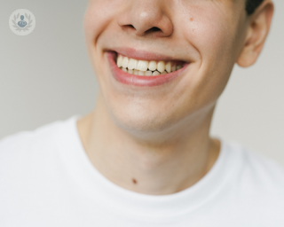 Young man who has had periodontal plastic surgery for receeding gums.