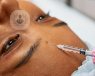 A young woman receiving a skin injection treatment