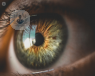 Refractive surgery: an informative insight