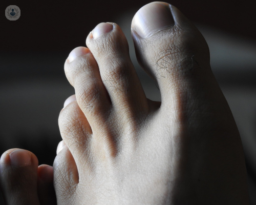 An image of a toe