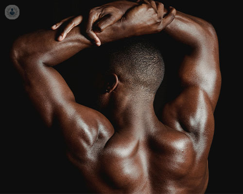 A man flexes, showing off the results of shoulder surgery