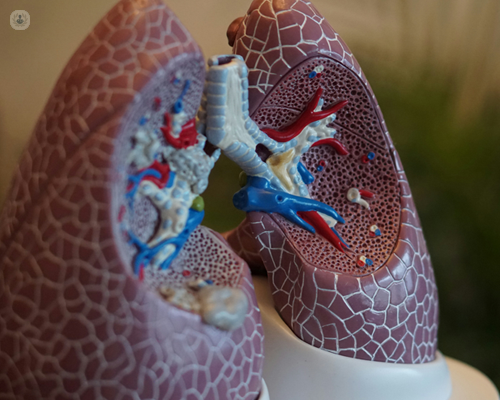 COPD is a progressive lung condition, and early diagnosis is essential.