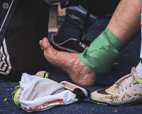 Achilles tendon rupture, Bupa UK