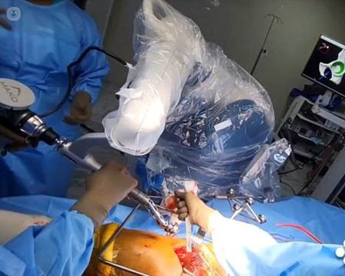 Robotic-assisted hip replacement surgery