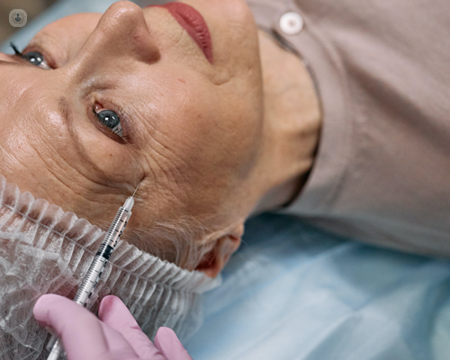 Woman having exosome treatment for wrinkles