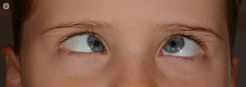 Crossed Eyes (Strabismus): Definition, Types, Causes, Symptoms, and  Treatments