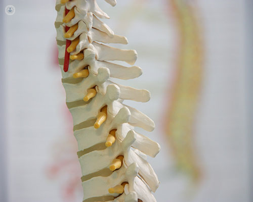 A model of spine which can be affected by cervical disc herniation