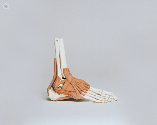 Skeleton model of a foot, which can be treated on with bunion surgery.