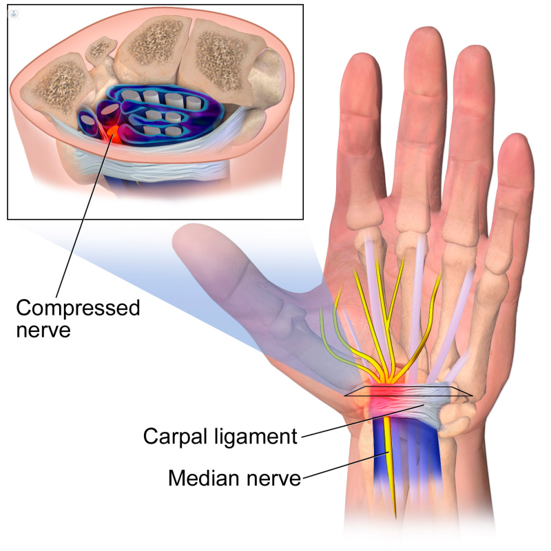 radial nerve wrist