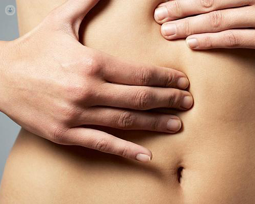 What is a Hernia and How is it Treated?