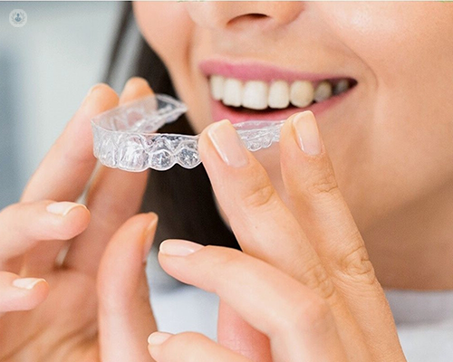 Invisalign Clear Braces Treatment for Crowded Teeth - Define Clinic London  & Beaconsfield
