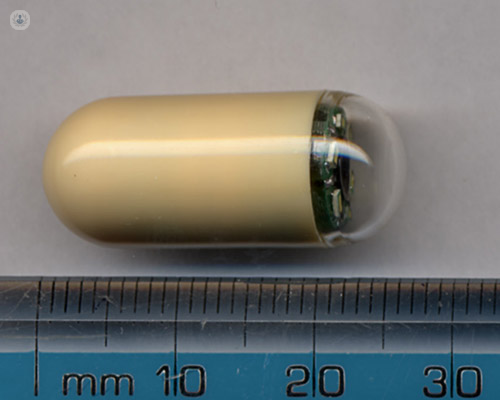 Capsule endoscopy: What to expect, results, and more