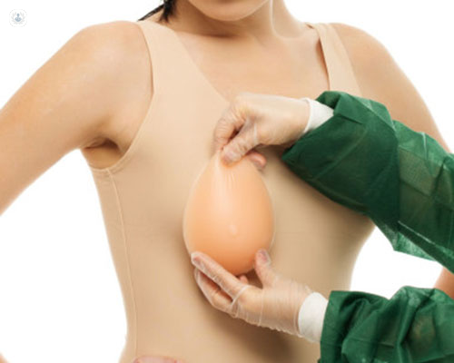 Why I removed my post-mastectomy breast implants.