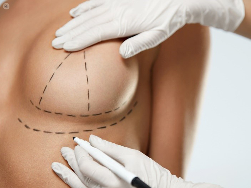Nice Lift Breast Enlargement – The Harley Laser Clinic
