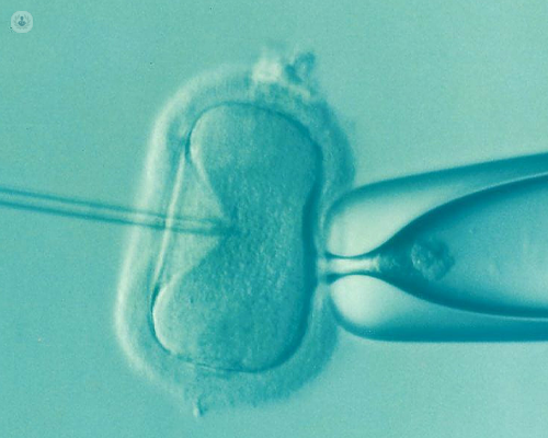 PGT-A analyses cells from an embryo created during an IVF cycle.