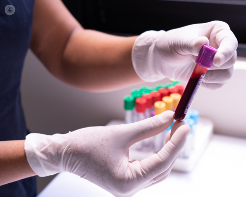 Blood sample used for platelet-rich plasma (PRP) therapy.