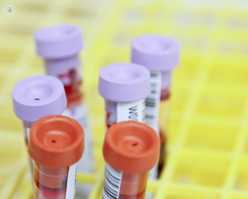 Blood test measuring rheumatoid factor